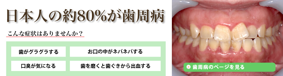 関原デンタルオフィスの歯周病治療