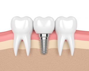AD3E595C-0D75-46FF-8289-D20168CE4A86